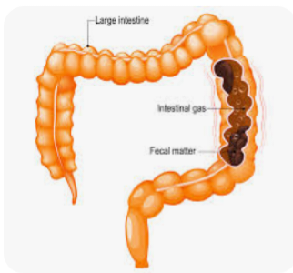 colon constipé